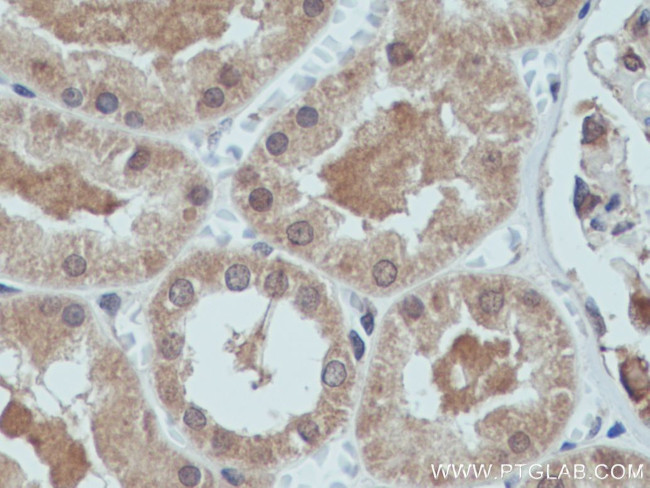 GLI2 Antibody in Immunohistochemistry (Paraffin) (IHC (P))