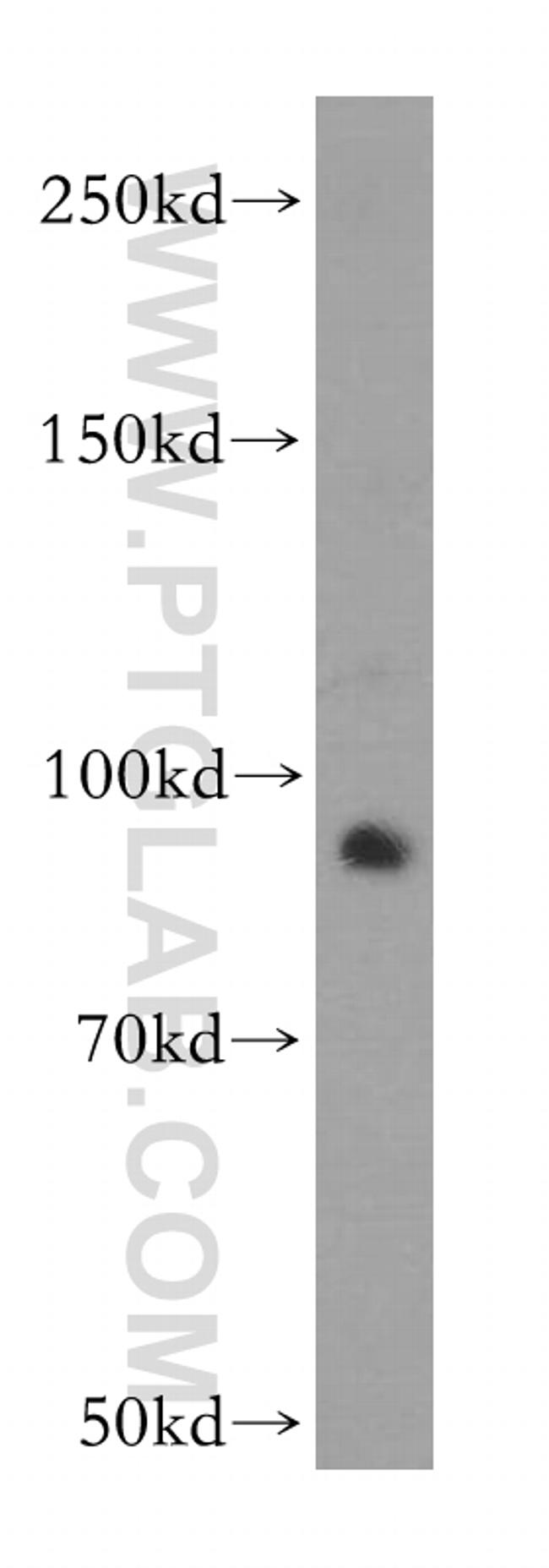 GLI2 Antibody in Western Blot (WB)