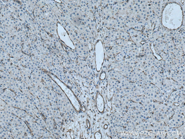 BSEP Antibody in Immunohistochemistry (Paraffin) (IHC (P))