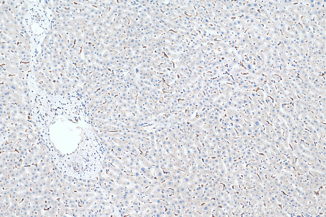 BSEP Antibody in Immunohistochemistry (Paraffin) (IHC (P))