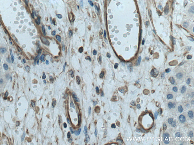 BSEP Antibody in Immunohistochemistry (Paraffin) (IHC (P))