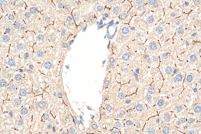 BSEP Antibody in Immunohistochemistry (Paraffin) (IHC (P))