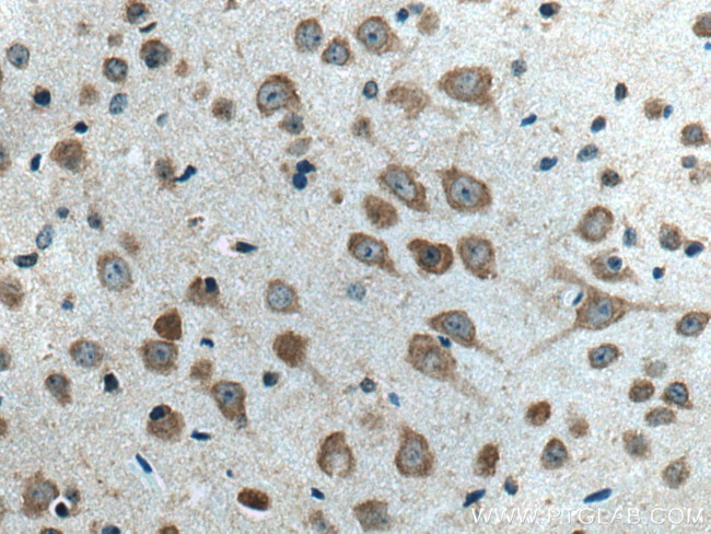 SLC24A4 Antibody in Immunohistochemistry (Paraffin) (IHC (P))