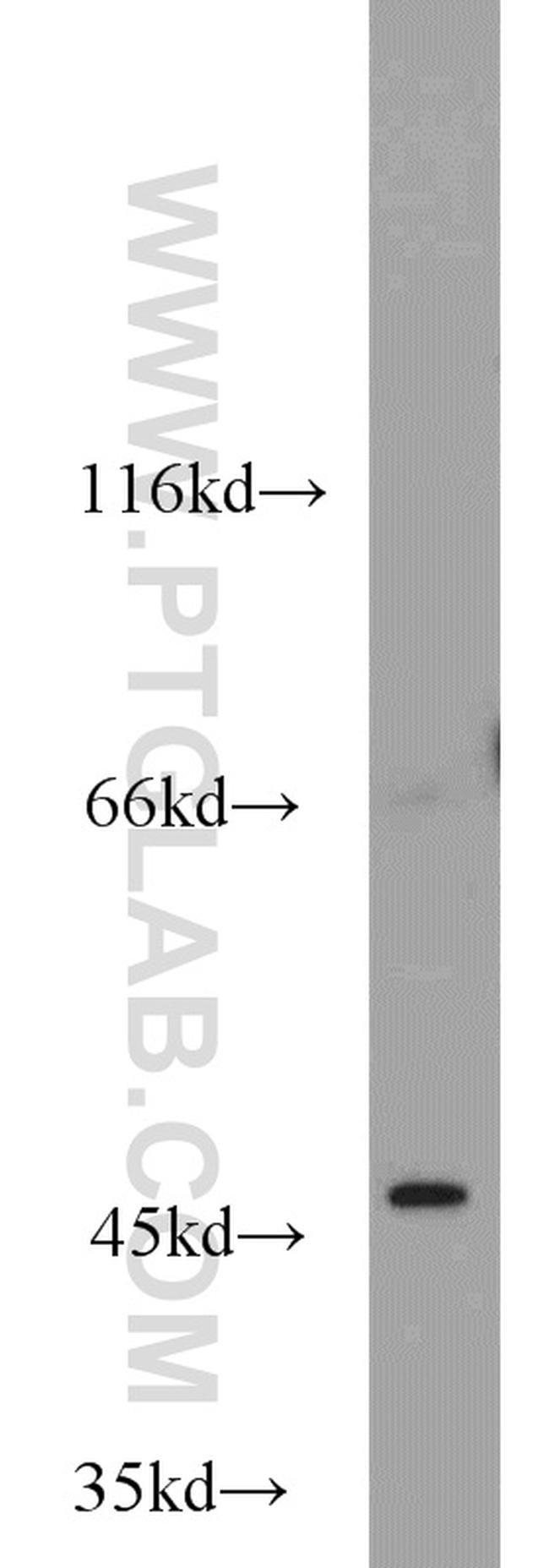 Oct6 Antibody in Western Blot (WB)