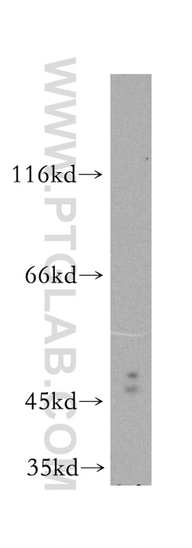 Oct6 Antibody in Western Blot (WB)