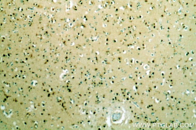 BRN2 Antibody in Immunohistochemistry (Paraffin) (IHC (P))