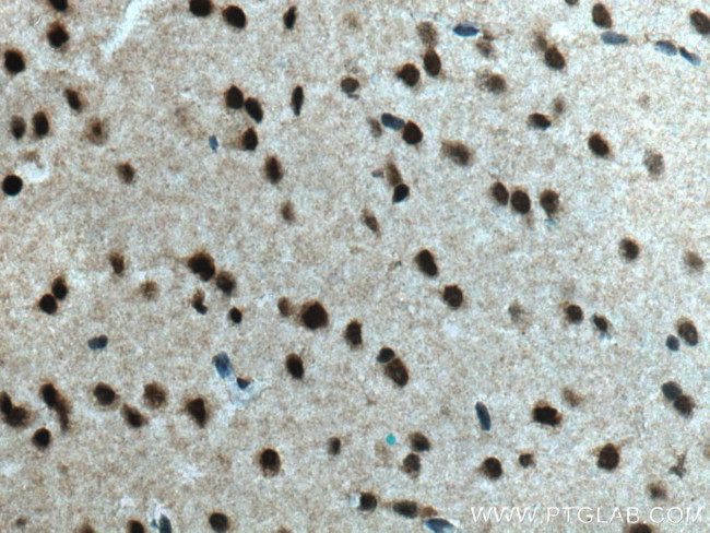 BRN2 Antibody in Immunohistochemistry (Paraffin) (IHC (P))