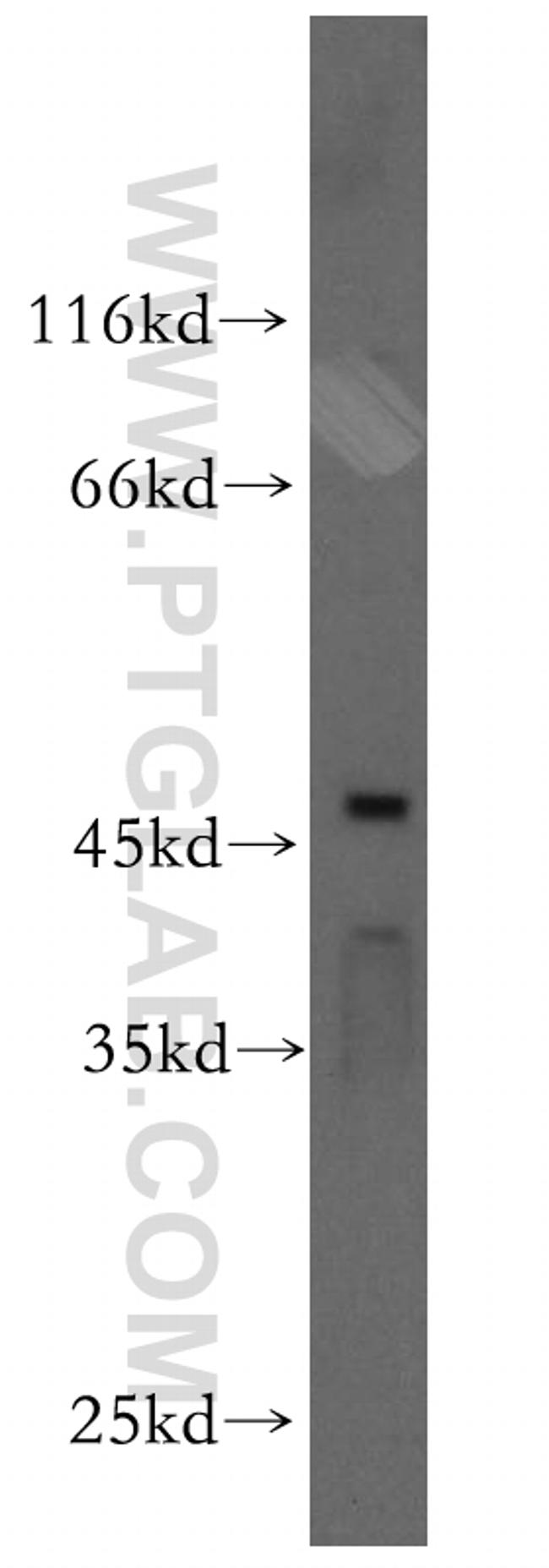 BRN2 Antibody in Western Blot (WB)