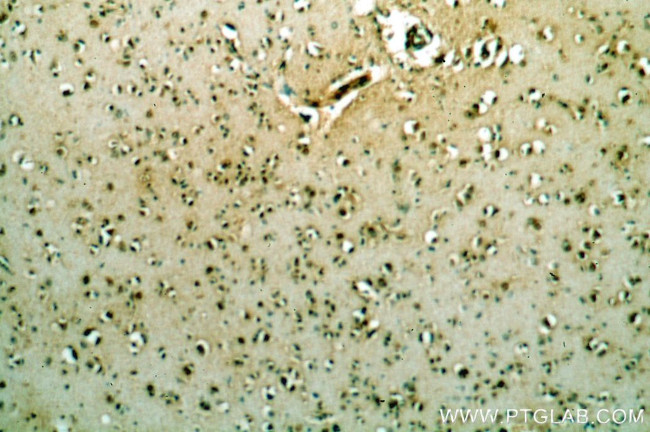 POU3F3 Antibody in Immunohistochemistry (Paraffin) (IHC (P))