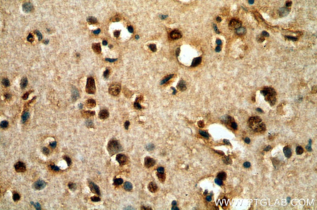 POU3F3 Antibody in Immunohistochemistry (Paraffin) (IHC (P))