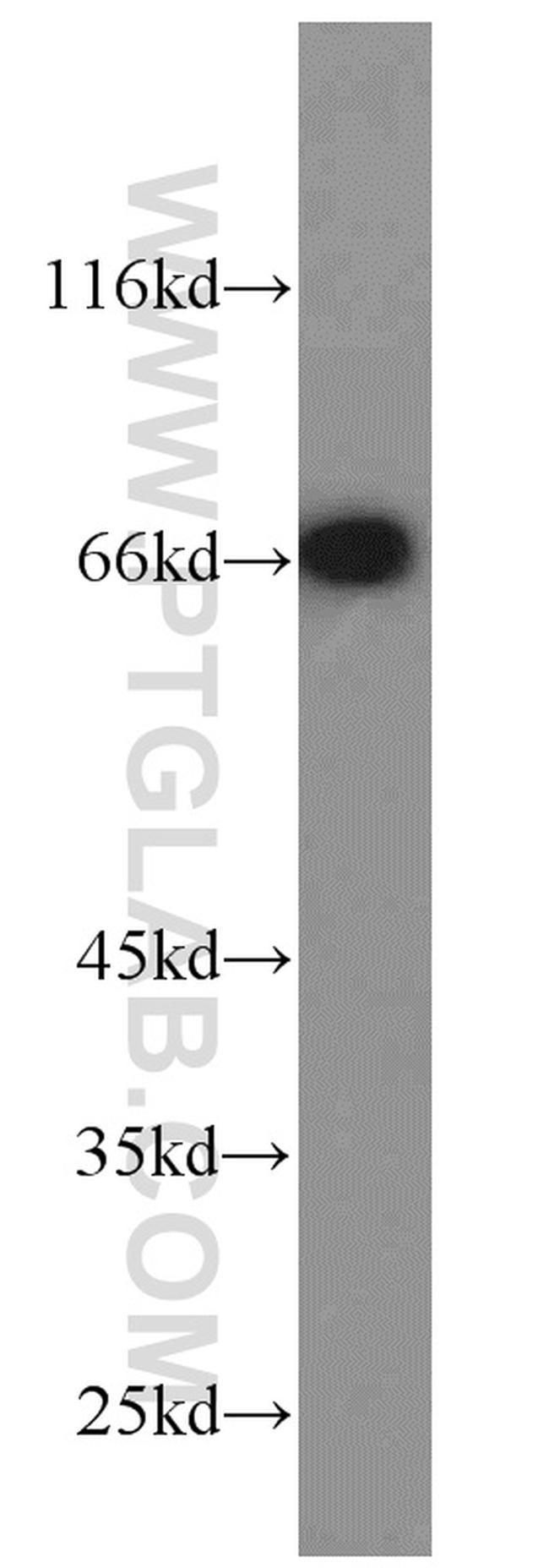 POU3F3 Antibody in Western Blot (WB)