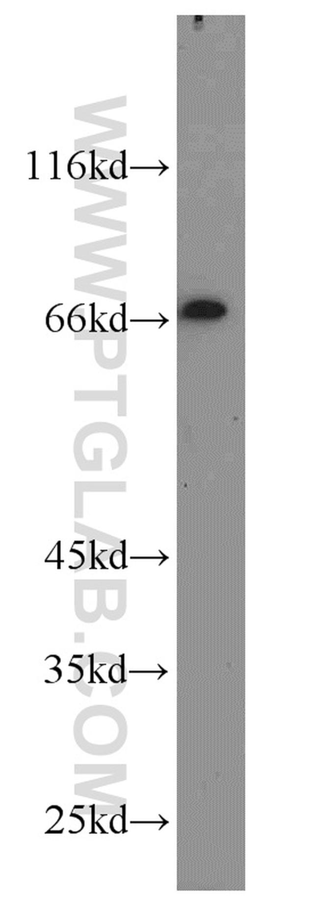 POU3F3 Antibody in Western Blot (WB)