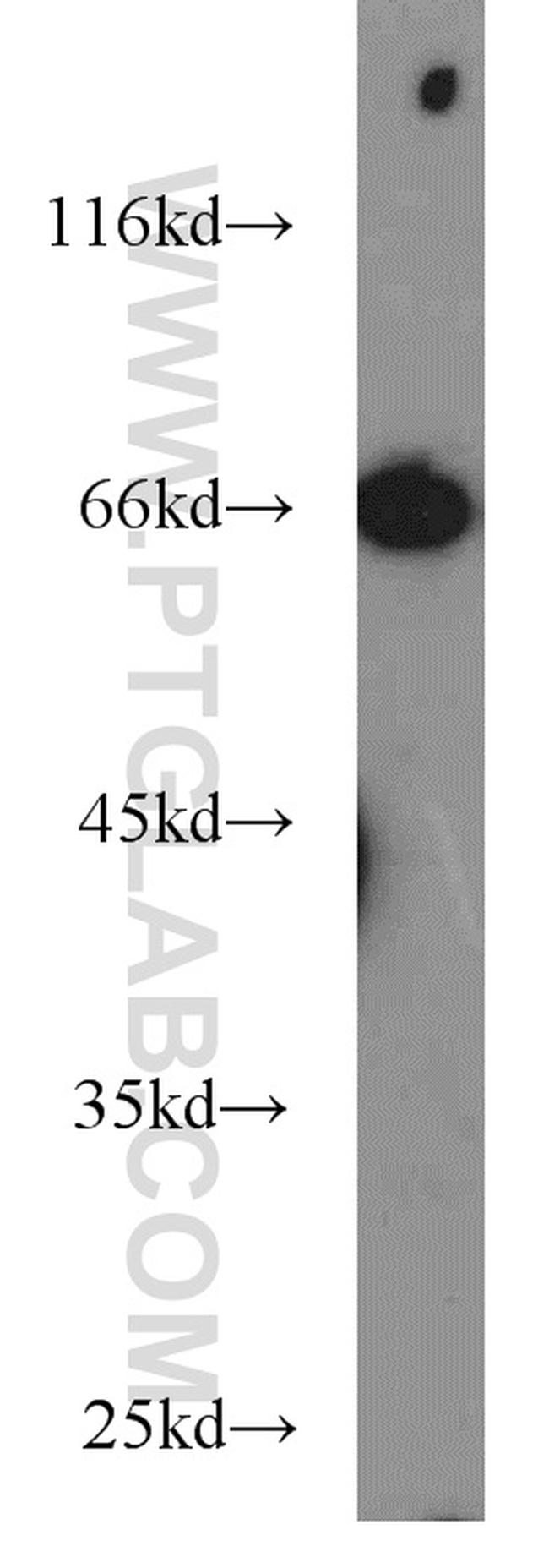 POU3F3 Antibody in Western Blot (WB)