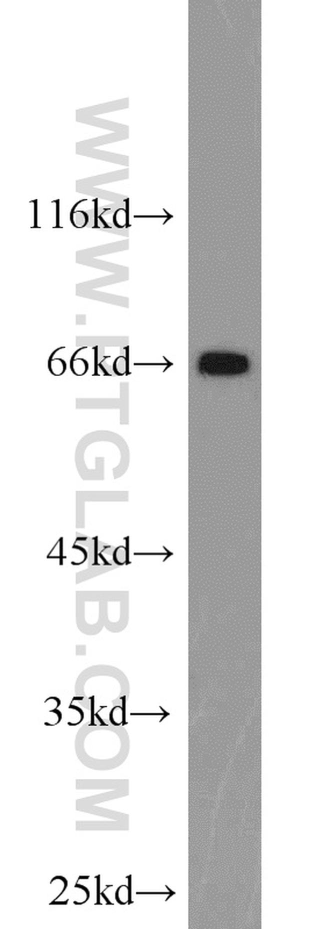 POU3F3 Antibody in Western Blot (WB)