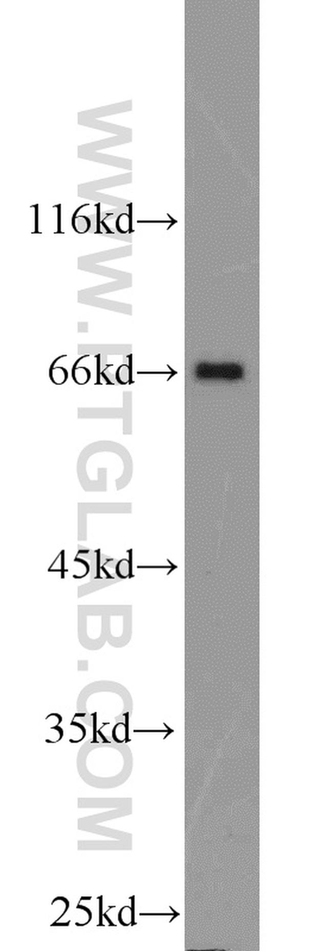 POU3F3 Antibody in Western Blot (WB)