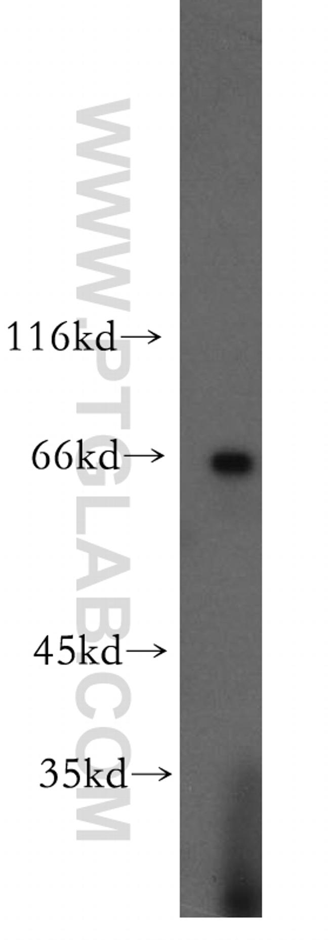 POU3F3 Antibody in Western Blot (WB)