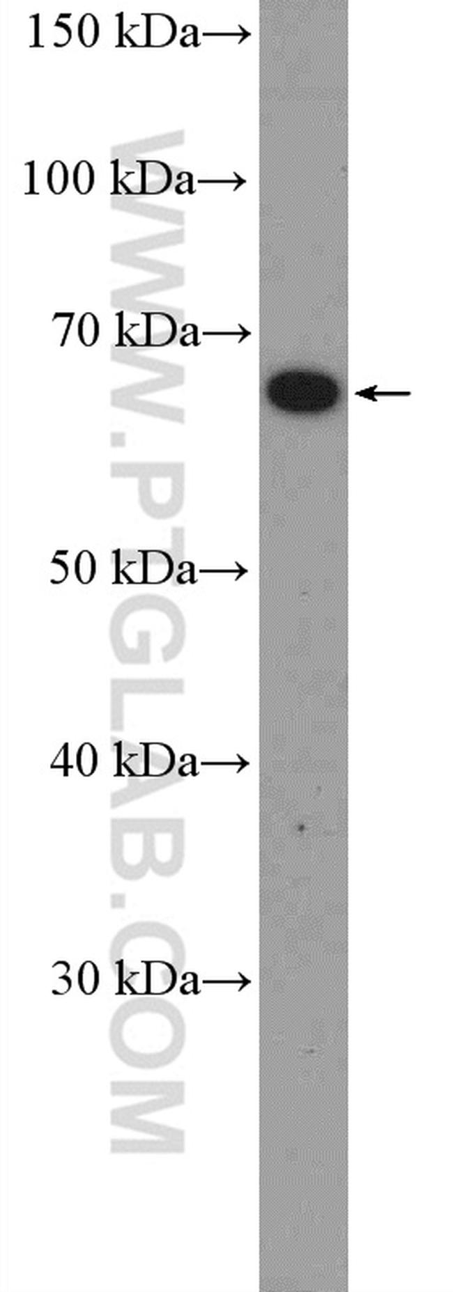 POU3F3 Antibody in Western Blot (WB)