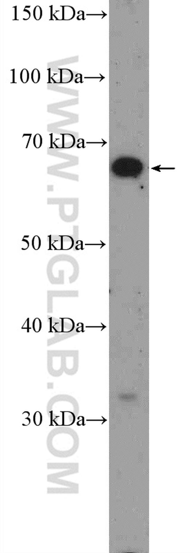 POU3F3 Antibody in Western Blot (WB)