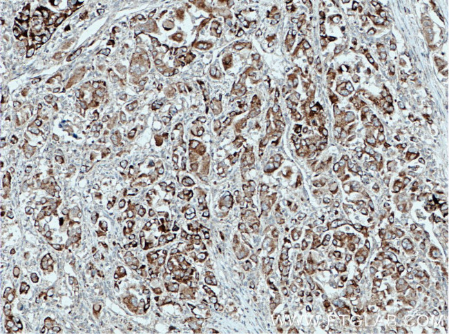 VEGF Antibody in Immunohistochemistry (Paraffin) (IHC (P))