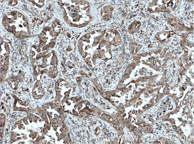 VEGF Antibody in Immunohistochemistry (Paraffin) (IHC (P))