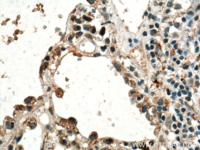 VEGF Antibody in Immunohistochemistry (Paraffin) (IHC (P))