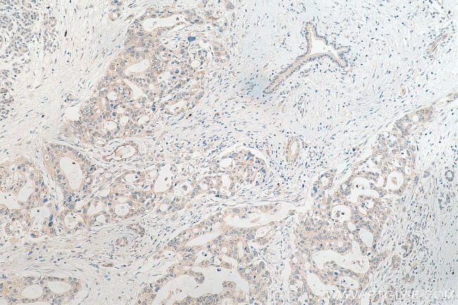 ZFP36L2 Antibody in Immunohistochemistry (Paraffin) (IHC (P))