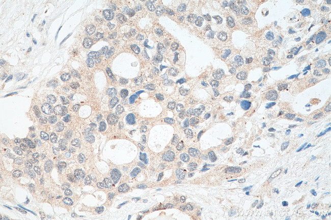 ZFP36L2 Antibody in Immunohistochemistry (Paraffin) (IHC (P))