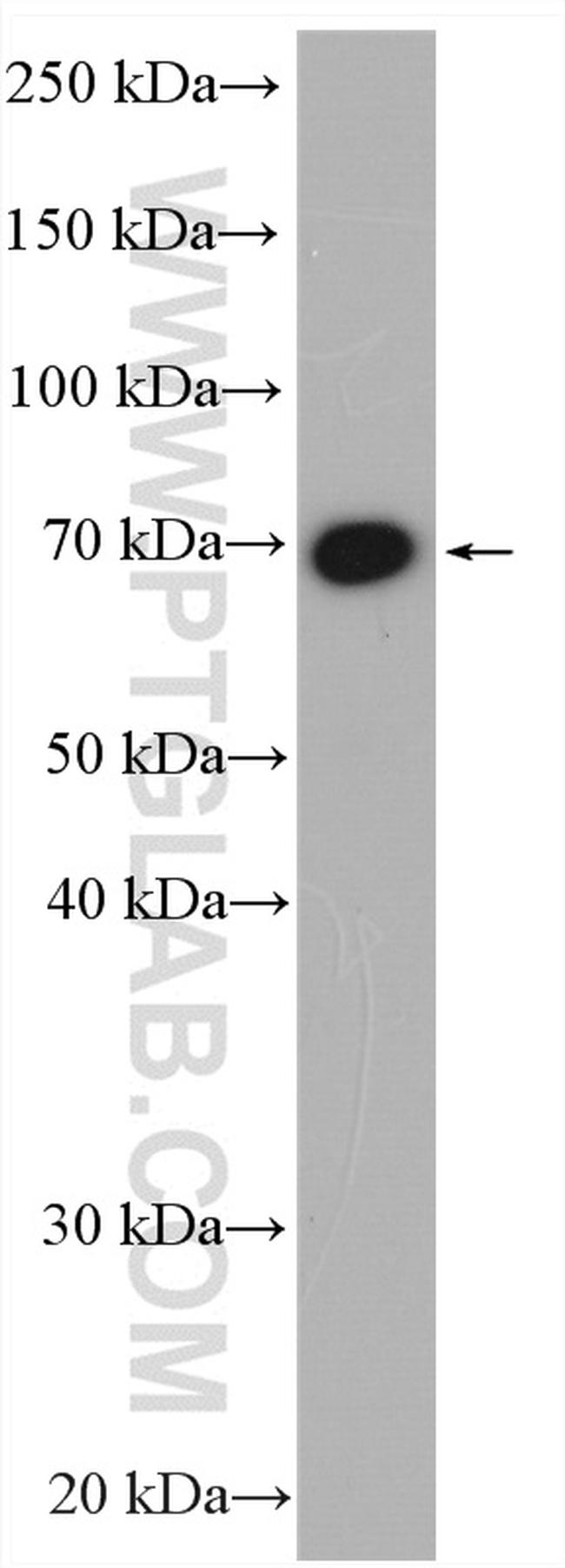 GUCY1B3 Antibody in Western Blot (WB)