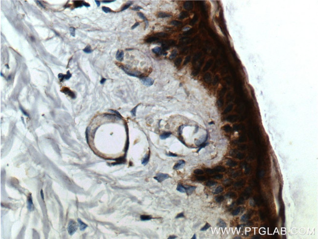 NOX2 Antibody in Immunohistochemistry (Paraffin) (IHC (P))