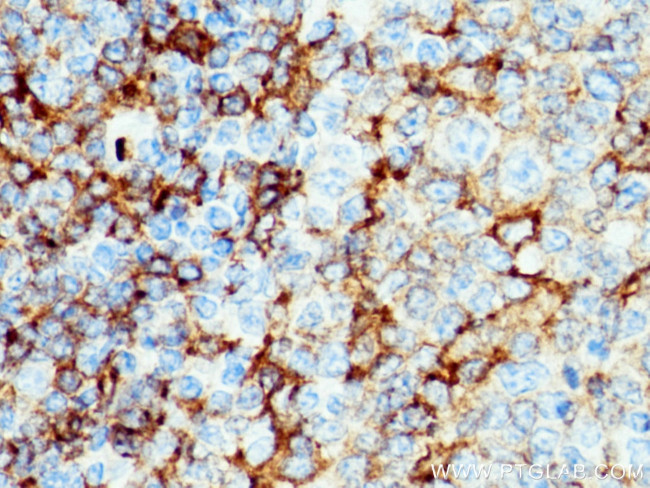 NOX2 Antibody in Immunohistochemistry (Paraffin) (IHC (P))