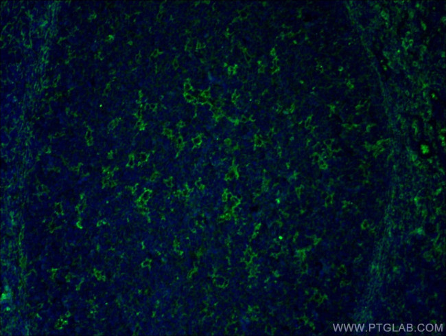 NOX2 Antibody in Immunohistochemistry (PFA fixed) (IHC (PFA))