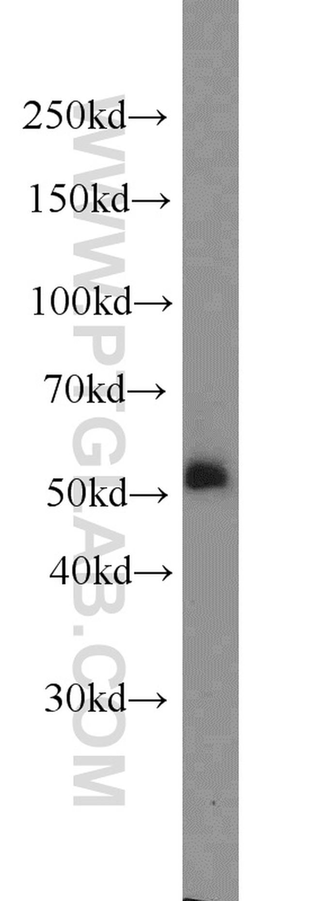 NOX2 Antibody in Western Blot (WB)