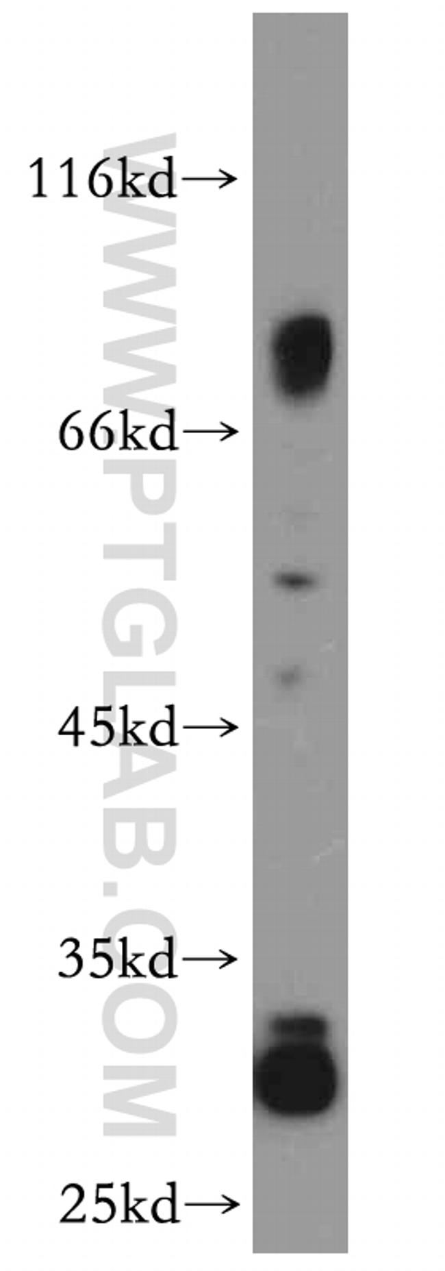 DPP7 Antibody in Western Blot (WB)