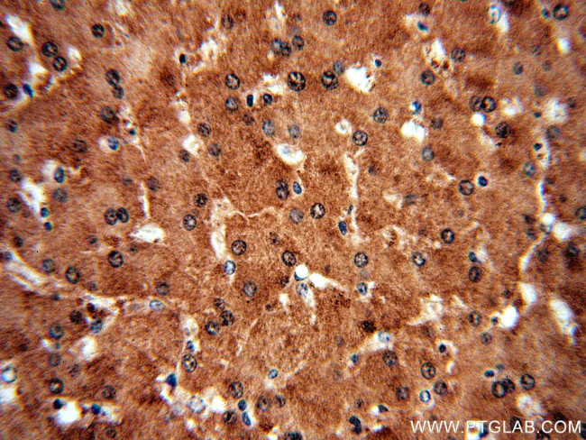 SGMS1 Antibody in Immunohistochemistry (Paraffin) (IHC (P))