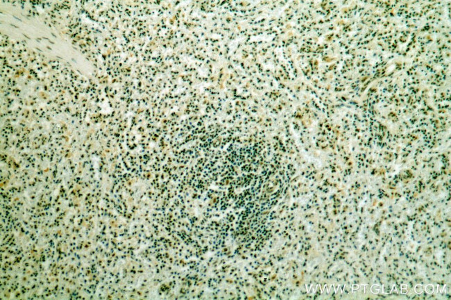 IKZF3 Antibody in Immunohistochemistry (Paraffin) (IHC (P))