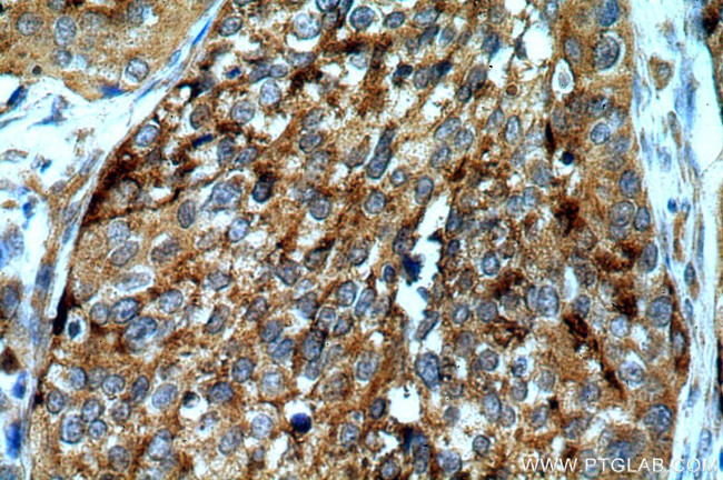 ARSA Antibody in Immunohistochemistry (Paraffin) (IHC (P))