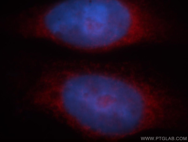 BAG1 Antibody in Immunocytochemistry (ICC/IF)