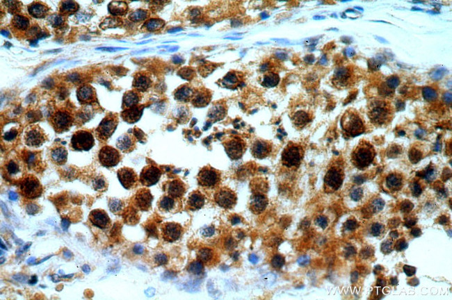 BAG1 Antibody in Immunohistochemistry (Paraffin) (IHC (P))