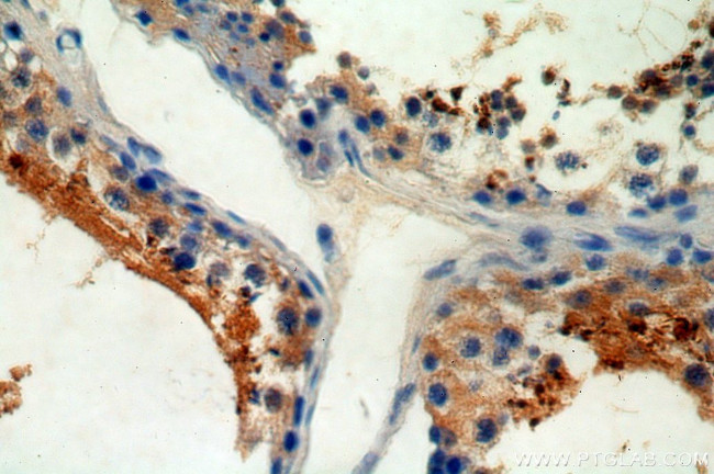 CRISP2 Antibody in Immunohistochemistry (Paraffin) (IHC (P))