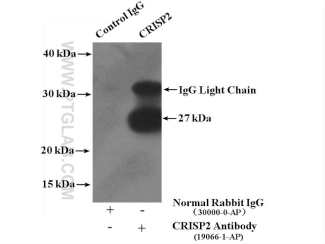 CRISP2 Antibody in Immunoprecipitation (IP)