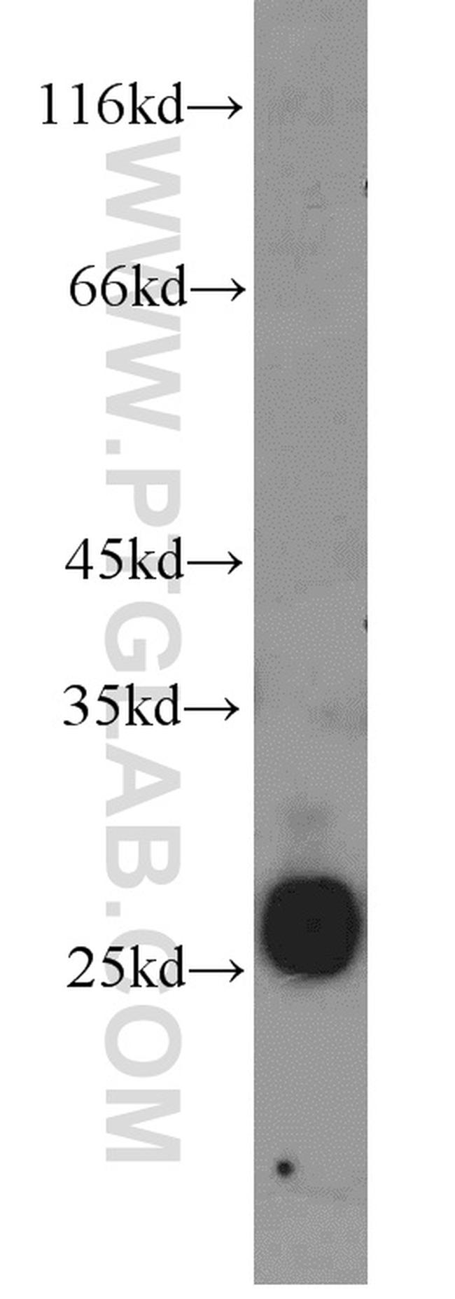 CRISP2 Antibody in Western Blot (WB)