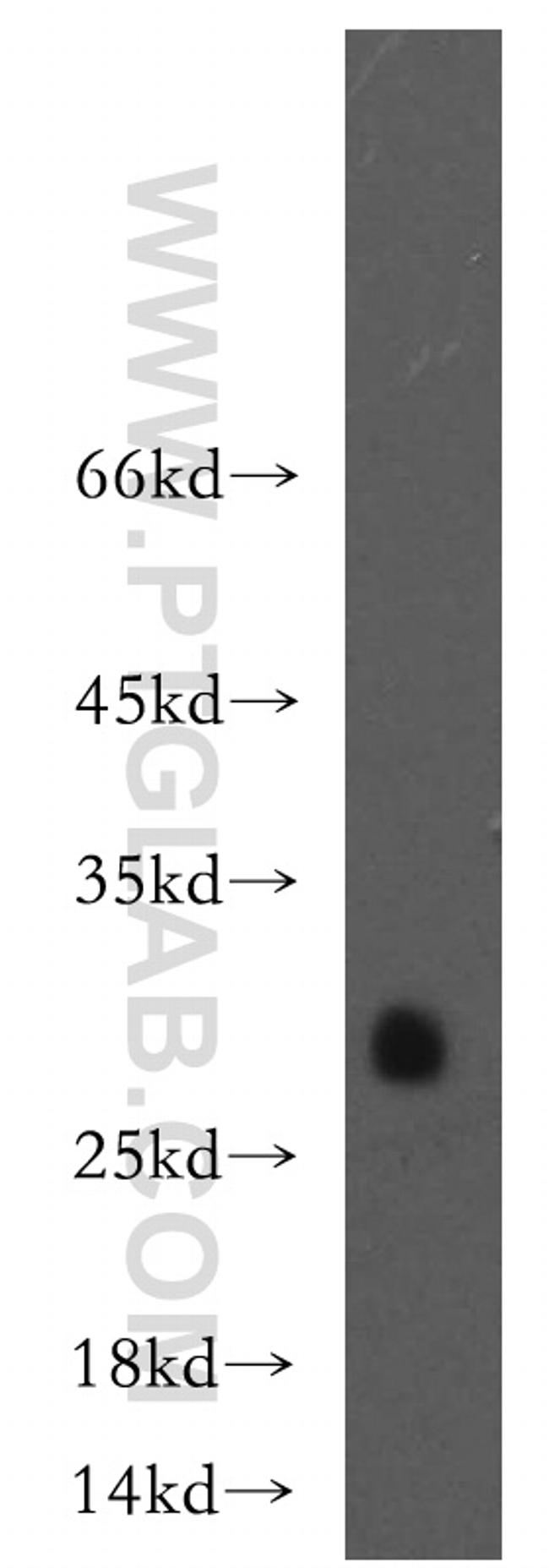 CRISP2 Antibody in Western Blot (WB)