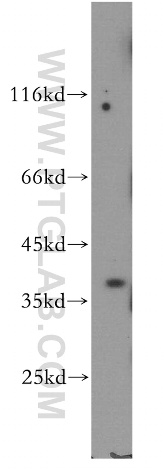 BRUNOL6 Antibody in Western Blot (WB)