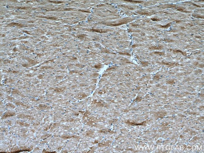 BMPR2 Antibody in Immunohistochemistry (Paraffin) (IHC (P))