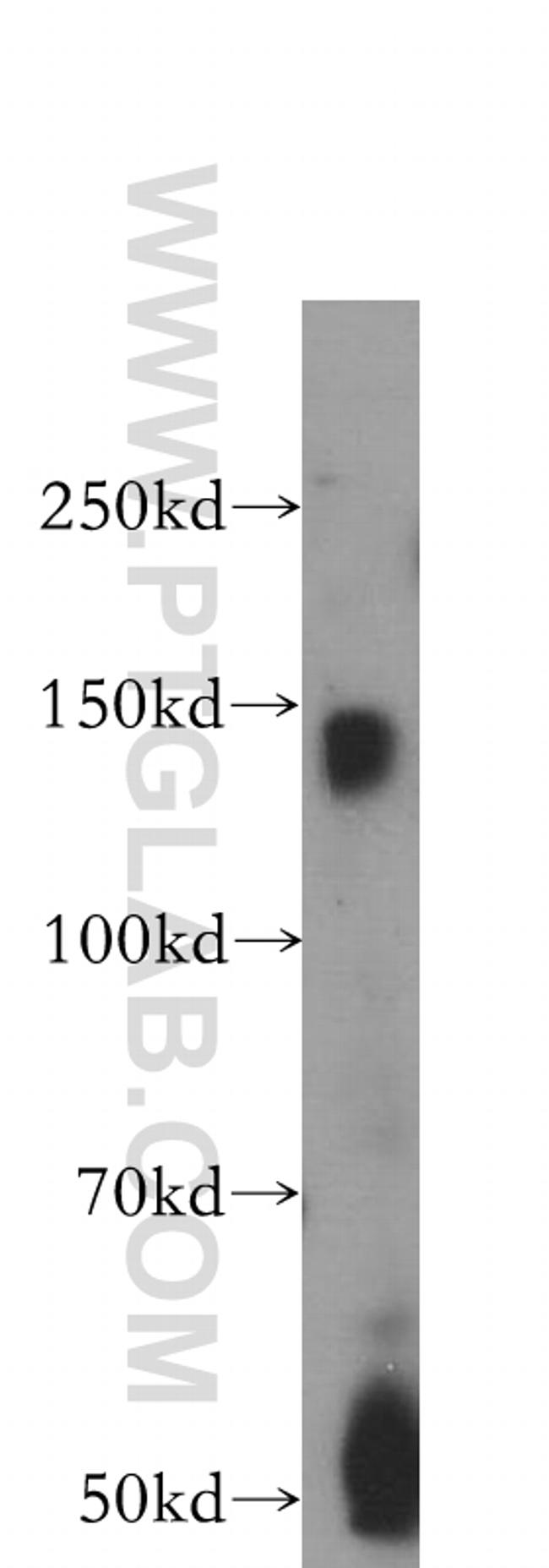 BMPR2 Antibody in Western Blot (WB)