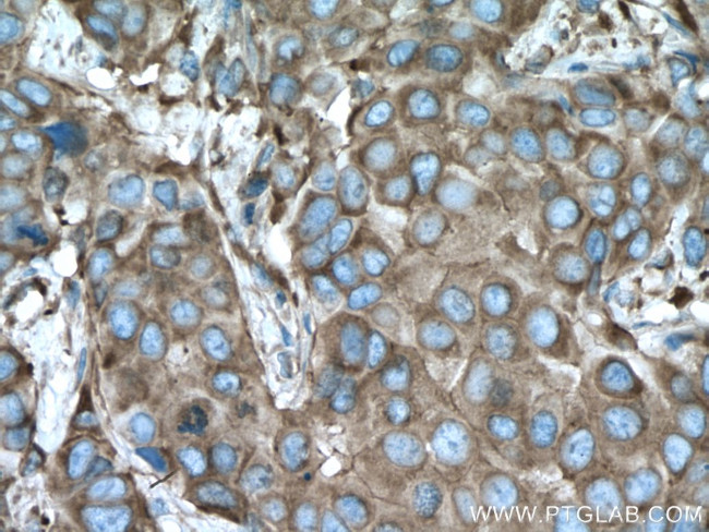 ACTN4 Antibody in Immunohistochemistry (Paraffin) (IHC (P))