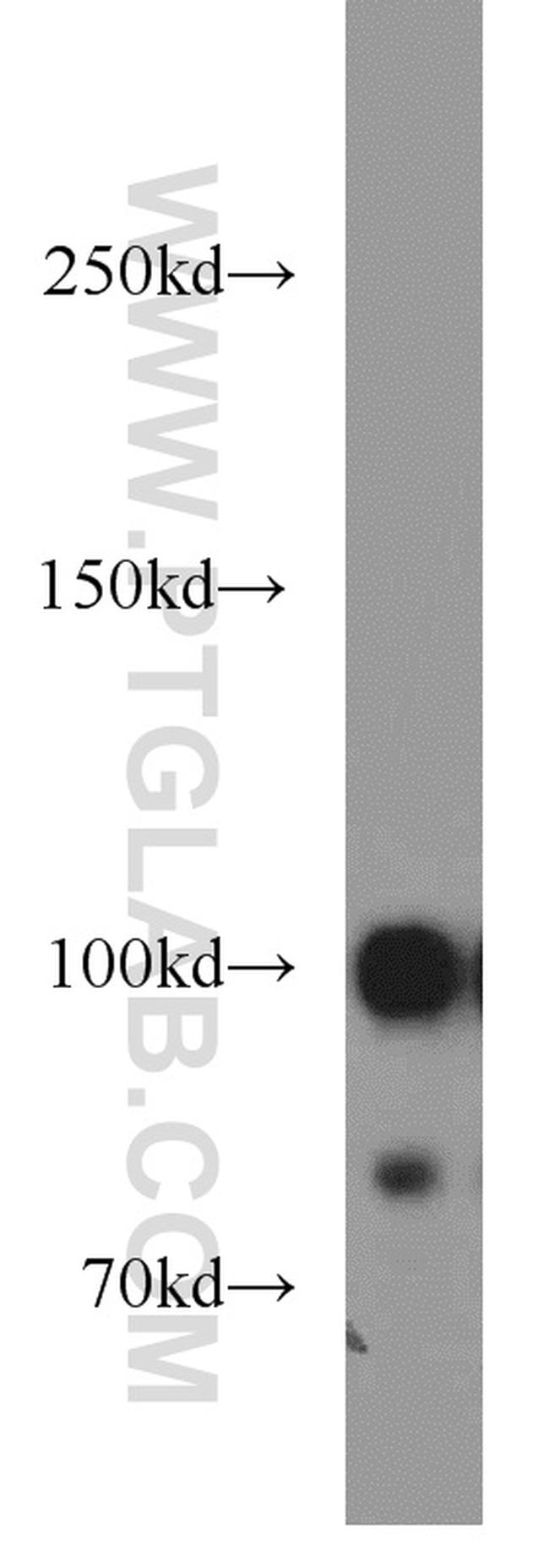 ACTN4 Antibody in Western Blot (WB)