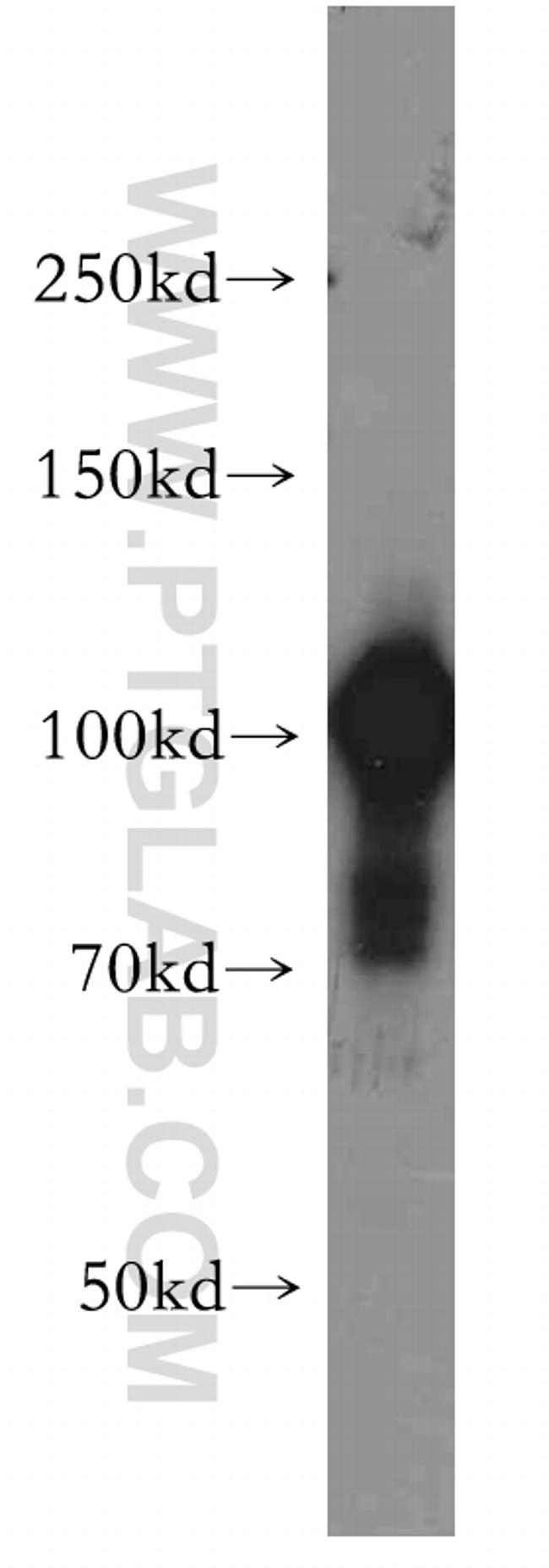 ACTN4 Antibody in Western Blot (WB)