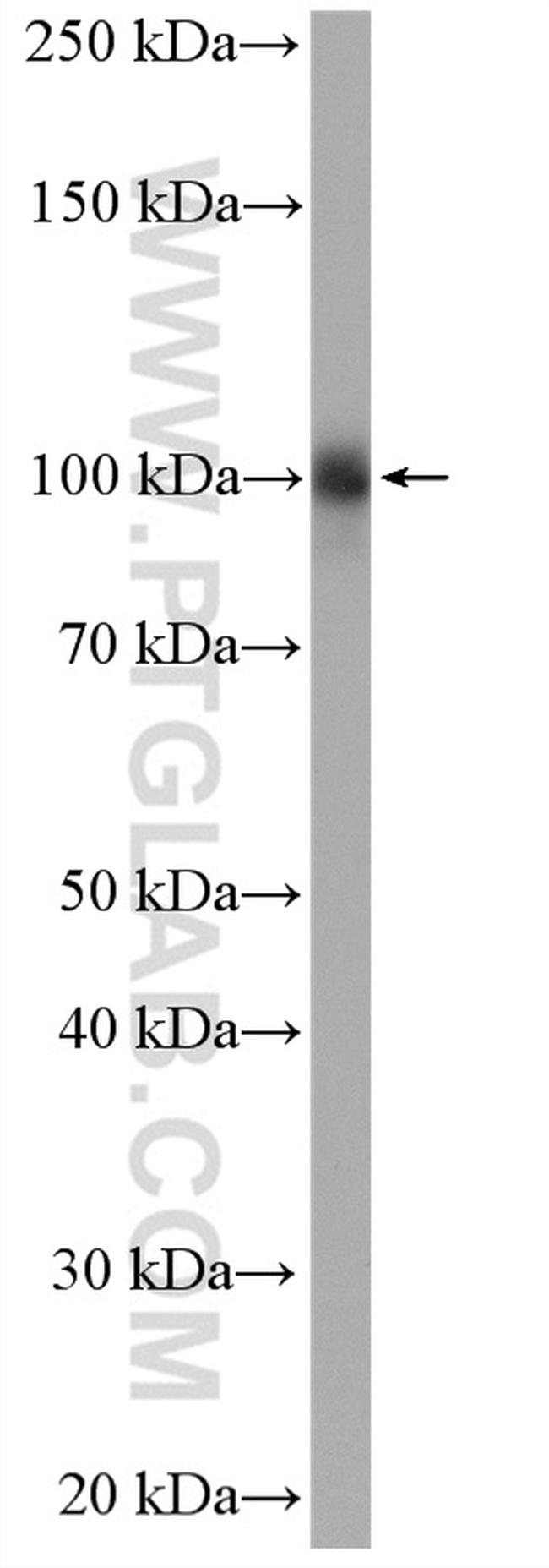 ACTN4 Antibody in Western Blot (WB)