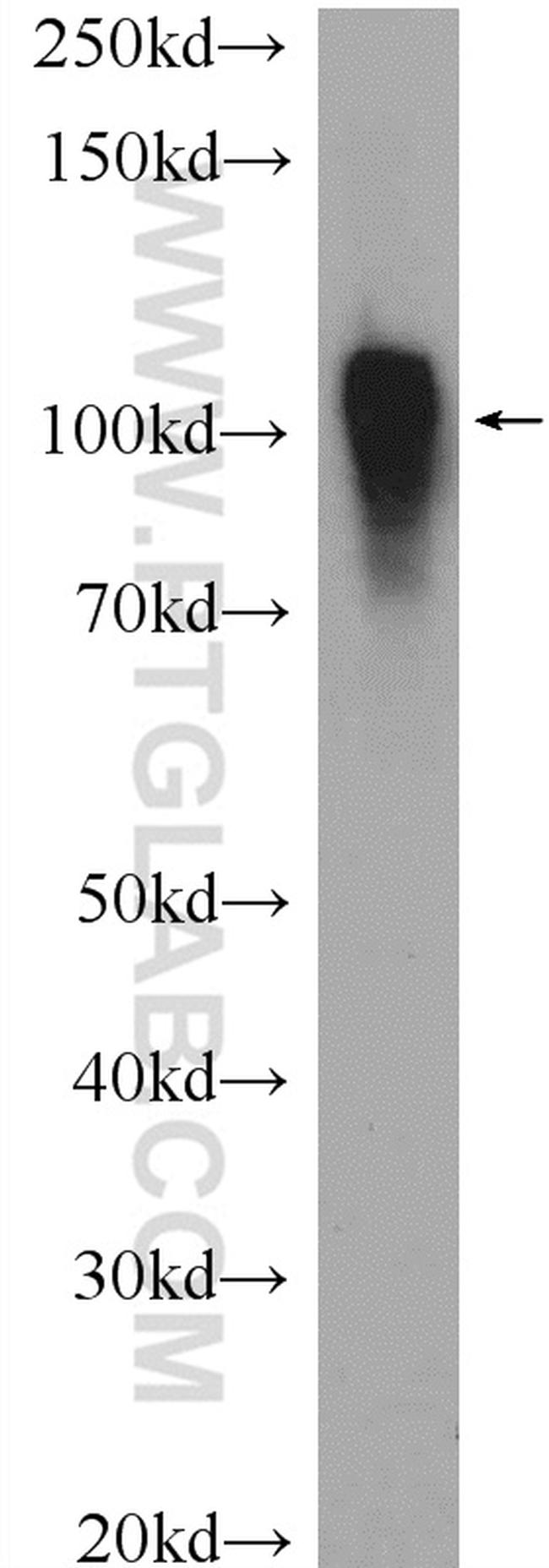 ACTN4 Antibody in Western Blot (WB)